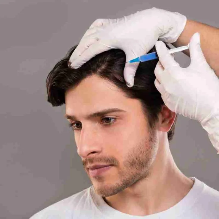 Man receiving a GFC hair treatment injection on the scalp