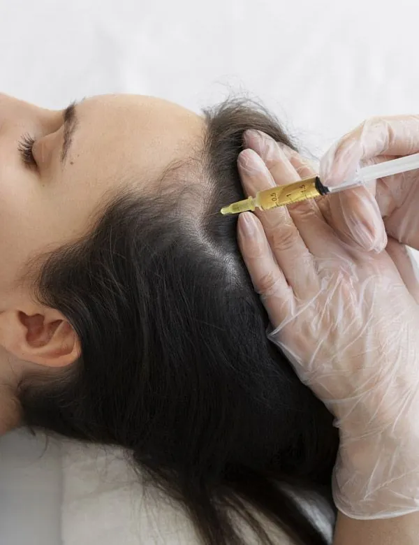 Hair mesotherapy injection along the scalp